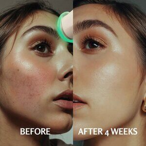 Cocobeauty PureO2 - Bioactive Delivery MicrOxygenation